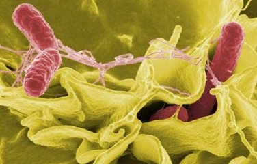 美国沙门氏菌感染者达100人 疑因食用某品牌麦片