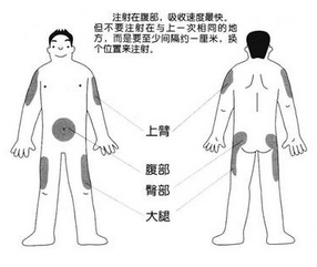 胰岛素注射的部位 分成腹部,上臂外侧 大腿外侧,臀部 可以说 就