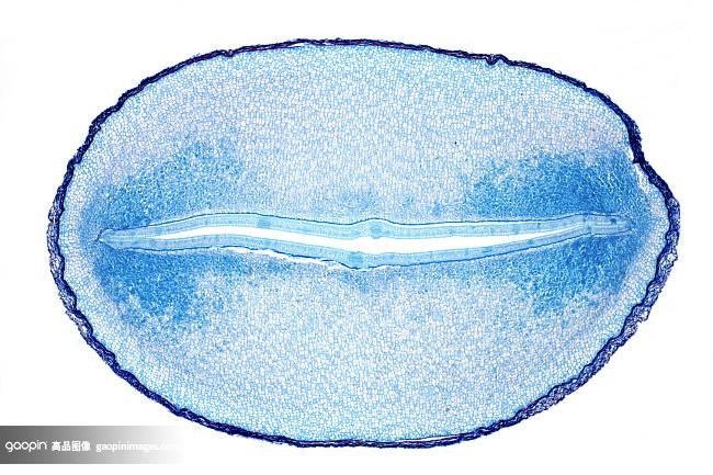 Castor oil plant seed, light micrograph Castor oil plant seed, light micrograph