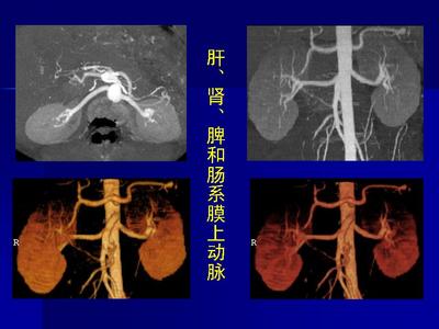 腹腔动脉e.肠系膜下动.